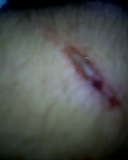 ma mutilation